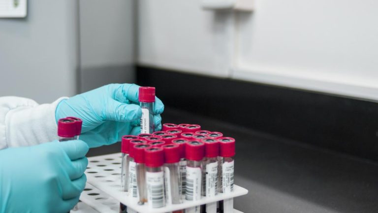 investigatiile-pentru-pacientii-cu-boli-cardiovasculare-cerebrovasculare-neurologice-renale-diabet-decontate-5455380