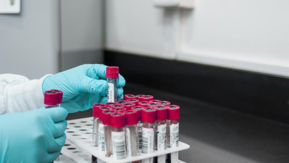 investigatiile-pentru-pacientii-cu-boli-cardiovasculare-cerebrovasculare-neurologice-renale-diabet-decontate-5455380
